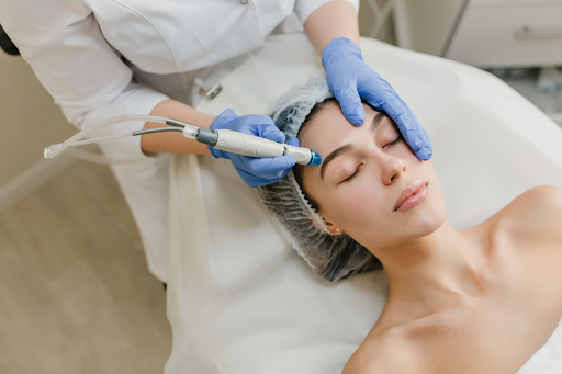HydraFacial-for-Acne-Prone